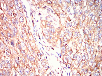 P4HB Antibody