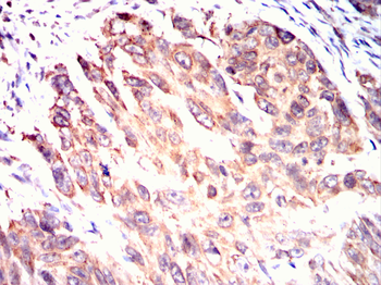 P4HB Antibody