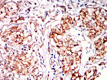 P4HB Antibody