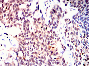 UCHL5 Antibody