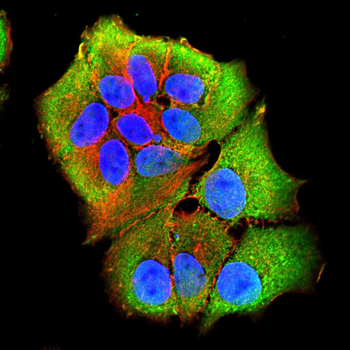 STAT5B Rabbit Polyclonal Antibody