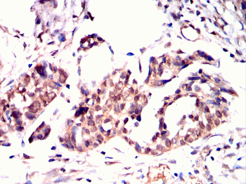 STAT5B Rabbit Polyclonal Antibody