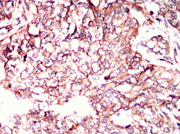 ERBB2 Antibody