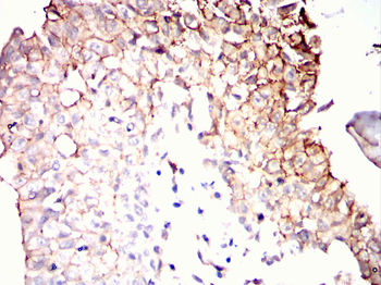 ERBB2 Antibody