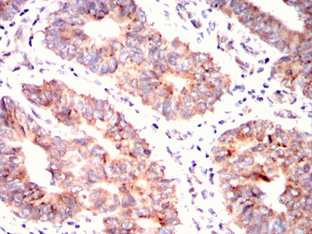 ERBB2 Antibody