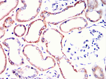 ERBB2 Antibody