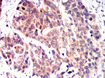 ERBB2 Antibody