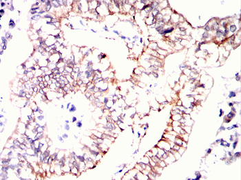 ERBB2 Antibody
