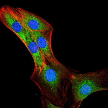 TAB2 Antibody