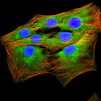 FCER2 Rabbit Polyclonal Antibody