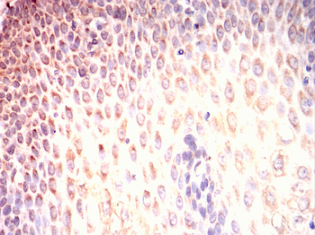 c-Rel Rabbit Polyclonal Antibody