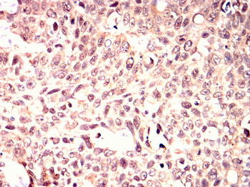 PDK1 Antibody