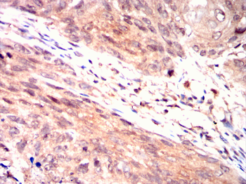 PDK1 Antibody
