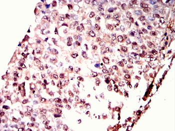 XRCC5 Antibody