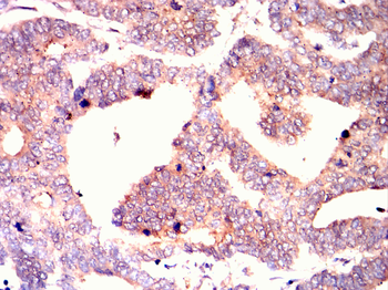 XRCC5 Antibody