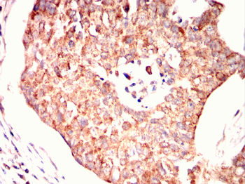 CPT2 Antibody