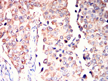 CPT2 Antibody