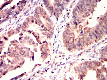 IGF2R Antibody