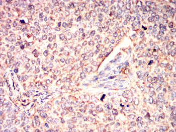 OLIG2 Antibody