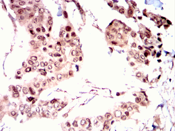 RAF1 Antibody