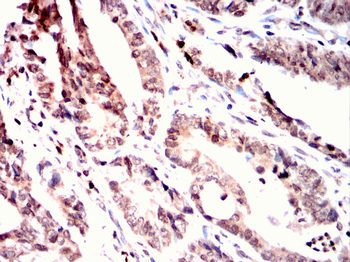 RAF1 Antibody