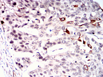 RAF1 Antibody