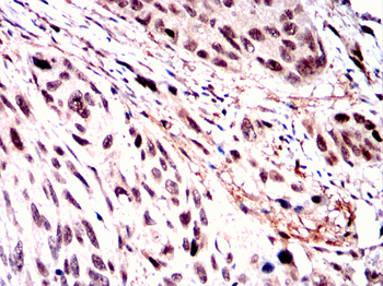 RAF1 Antibody