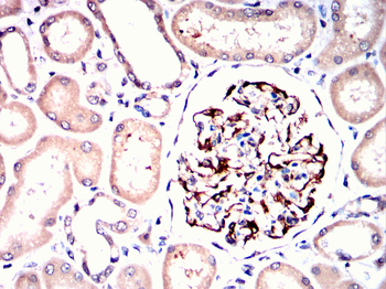 LRP5 Antibody