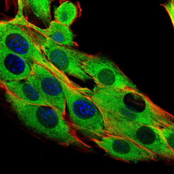 HLA-G Rabbit Polyclonal Antibody