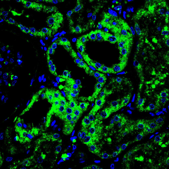 HLA-G Rabbit Polyclonal Antibody