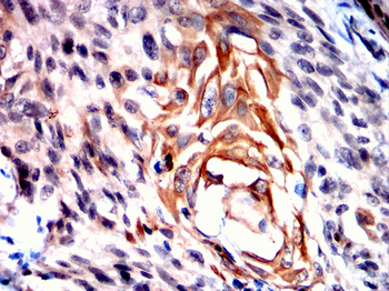 HLA-G Rabbit Polyclonal Antibody