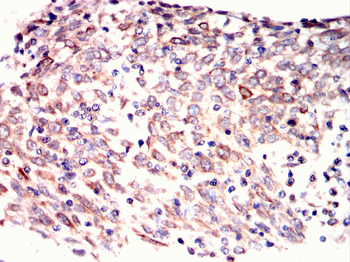 HLA-G Rabbit Polyclonal Antibody