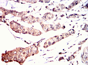 PSMB8 Antibody