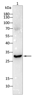 PSMB8 Antibody