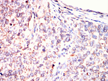 PKN2 Antibody
