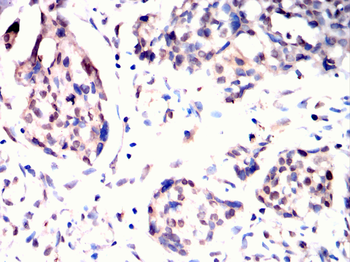 PKN2 Antibody