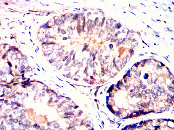 PKN2 Antibody