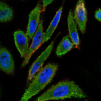 GRIA2 Antibody
