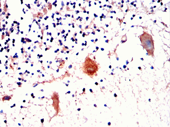 GRIA2 Antibody