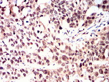ANXA1 Antibody
