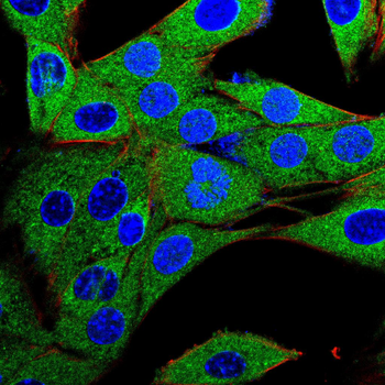 RPL18A Antibody