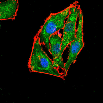CTNNB1 Antibody