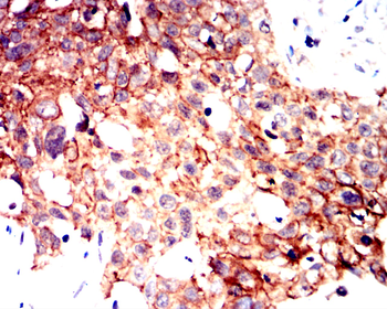 CTNNB1 Antibody