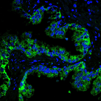 CTNNB1 Antibody