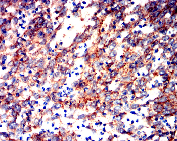 CTNNB1 Antibody