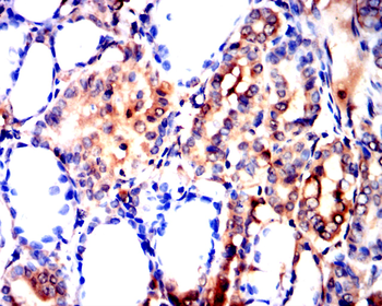 ALPP Antibody