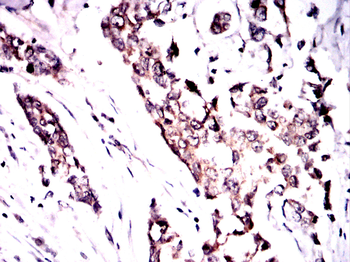 CFLAR Antibody