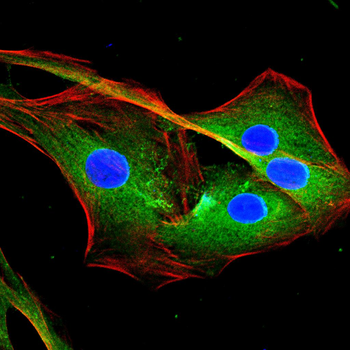 SFTPC Rabbit Polyclonal Antibody