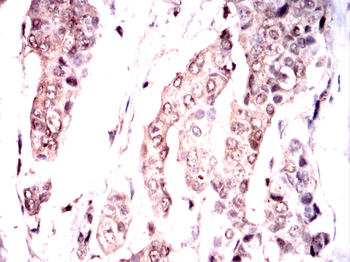 SQSTM1 Antibody
