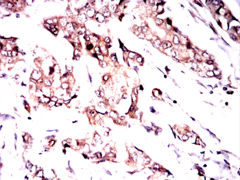 CFLAR Antibody